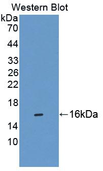 Polyclonal Antibody to Chibby Homolog 1 (CBY1)