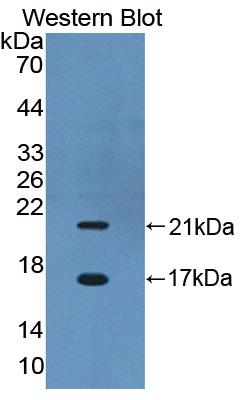 Polyclonal Antibody to Chibby Homolog 1 (CBY1)