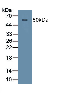 Polyclonal Antibody to Corneodesmosin (CDSN)