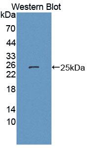 Polyclonal Antibody to Cytokine Inducible SH2 Containing Protein (CISH)