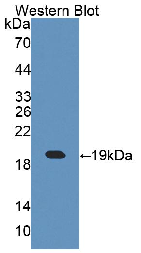 PAC398Hu01.jpg