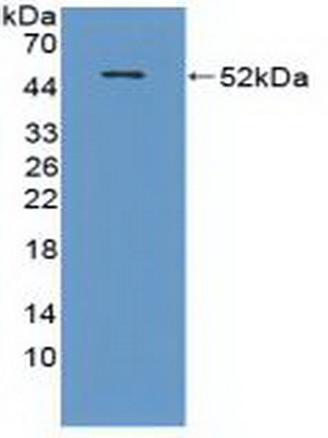 Polyclonal Antibody to Carnitine Acetyltransferase (CRAT)