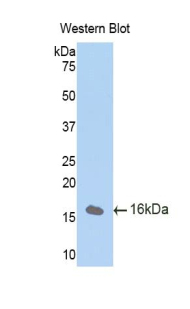 Polyclonal Antibody to Cubilin (CUBN)