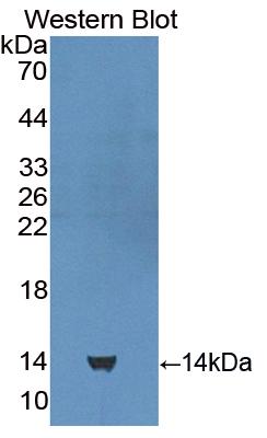 Polyclonal Antibody to Cubilin (CUBN)