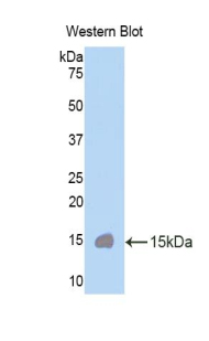 Polyclonal Antibody to Cubilin (CUBN)