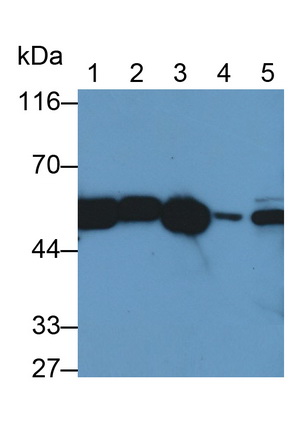 Polyclonal Antibody to Catalase (CAT)