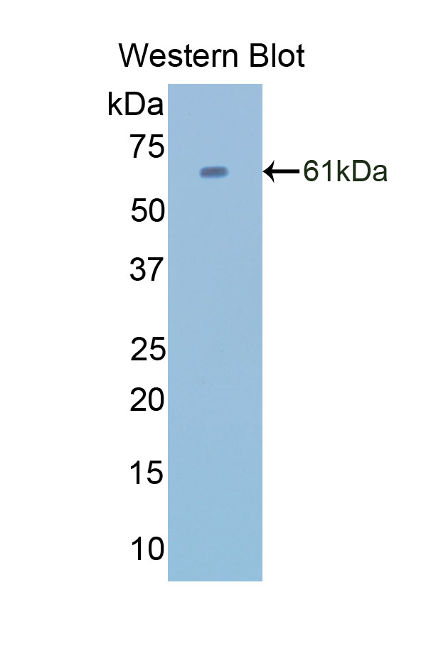 Polyclonal Antibody to Catalase (CAT)