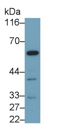 Polyclonal Antibody to Catalase (CAT)