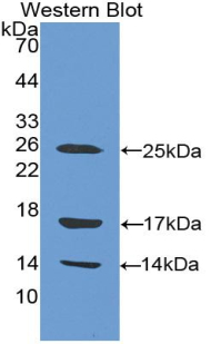 Polyclonal Antibody to Cathelicidin Antimicrobial Peptide (CAMP)