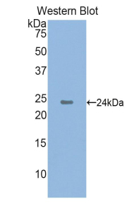 Biotin-Linked Polyclonal Antibody to Cathelicidin Antimicrobial Peptide (CAMP)