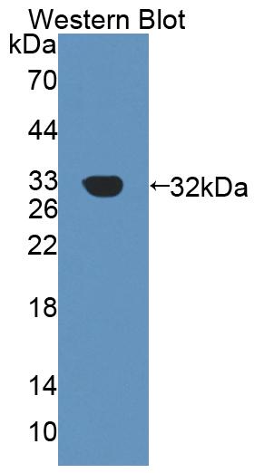 Polyclonal Antibody to Constitutive Androstane Receptor (CAR)