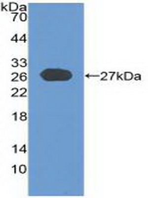 PAC423Hu01.jpg