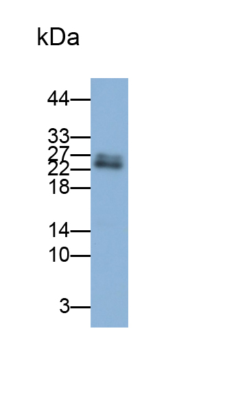 Polyclonal Antibody to Cytoglobin (CYGB)