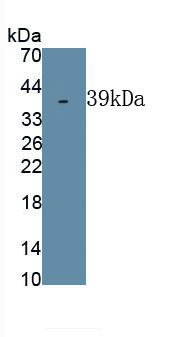 Polyclonal Antibody to Dentin Sialophosphoprotein (DSPP)