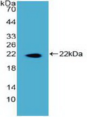 Polyclonal Antibody to Dyskerin (DKC)