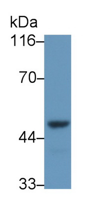 Polyclonal Antibody to Dyskerin (DKC)