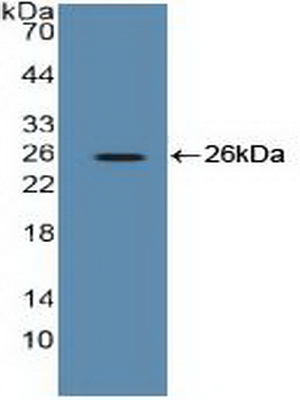 Polyclonal Antibody to Eukaryotic Translation Elongation Factor 2 (EEF2)