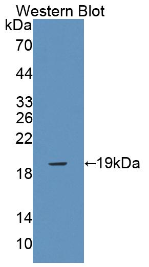 PAC461Hu01.jpg