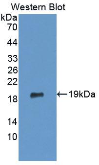 Polyclonal Antibody to Endoplasmic Reticulum Protein 29 (ERP29)