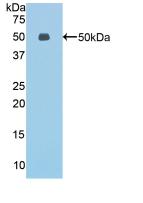 Polyclonal Antibody to Endothelial Cell Specific Molecule 1 (ESM1)