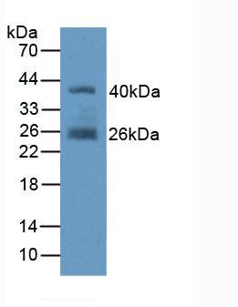 PAC469Hu01.jpg