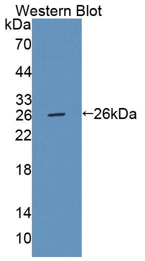 Polyclonal Antibody to Fas Activated Serine/Threonine Kinase (FASTK)