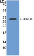 Polyclonal Antibody to Fibulin 1 (FBLN1)