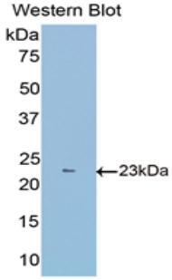 Polyclonal Antibody to Fibulin 1 (FBLN1)