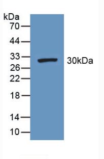 Polyclonal Antibody to Fibrinogen Gamma (FGg)