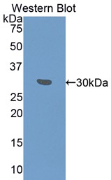 FITC-Linked Polyclonal Antibody to Fibrinogen Gamma (FGg)