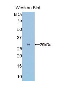 Polyclonal Antibody to Fibrinogen Gamma (FGg)