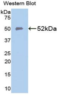 Polyclonal Antibody to Ferroportin (FPN)