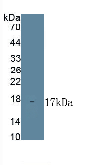 Polyclonal Antibody to Ferroportin (FPN)