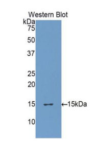 Polyclonal Antibody to Furin (FUR)