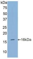 Polyclonal Antibody to Furin (FUR)