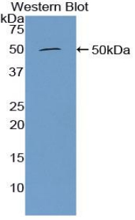 Polyclonal Antibody to Furin (FUR)