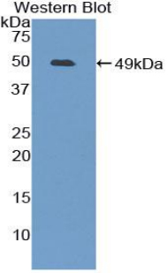 Polyclonal Antibody to Furin (FUR)