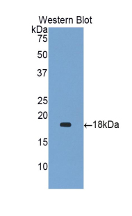 Polyclonal Antibody to Gastrokine 1 (GKN1)