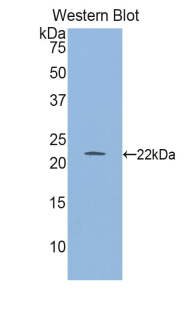 Polyclonal Antibody to Glyoxalase I (GLO1)