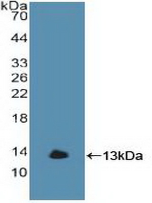 Polyclonal Antibody to Glucocerebrosidase (GBA)