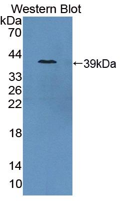 Polyclonal Antibody to Prostate-specific Membrane Antigen (PMSA)