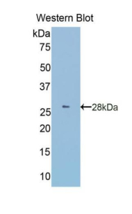 Polyclonal Antibody to Granulin (GRN)