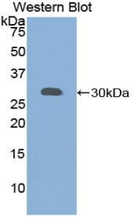 Polyclonal Antibody to Granulin (GRN)