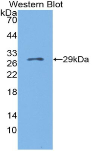 Polyclonal Antibody to Granulin (GRN)