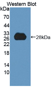 Polyclonal Antibody to High Density Lipoprotein Binding Protein (HDLBP)