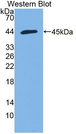 Polyclonal Antibody to Hemicentin 1 (HMCN1)