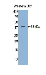 Polyclonal Antibody to Islet Cell Autoantigen 1 (ICA1)