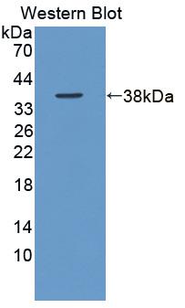 Polyclonal Antibody to Inositol Hexaphosphate Kinase 1 (IHPK1)