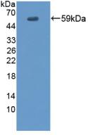 Polyclonal Antibody to Envoplakin (EVPL)