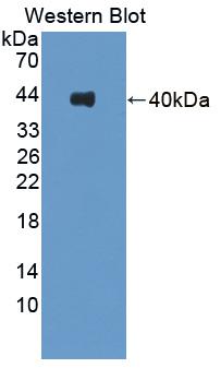 Polyclonal Antibody to Kinesin Light Chain 1 (KLC1)